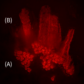 Fluoreszenzmikroskopische Aufnahme von Zellen im Darmepithel
