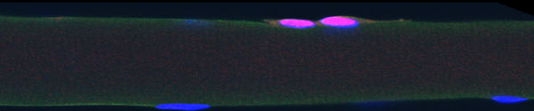 Satellite cells on a muscle fiber