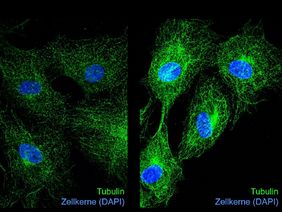 Immunfluoreszenzaufnahmen von Tubulin