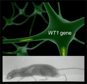 WT1 Gen & Bewegung
