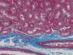 FLI: Mouse kidney