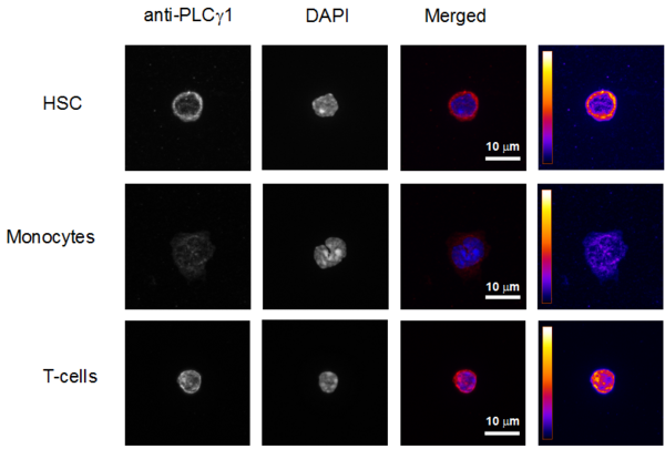 Plcg1 signaling Plcg1 signaling