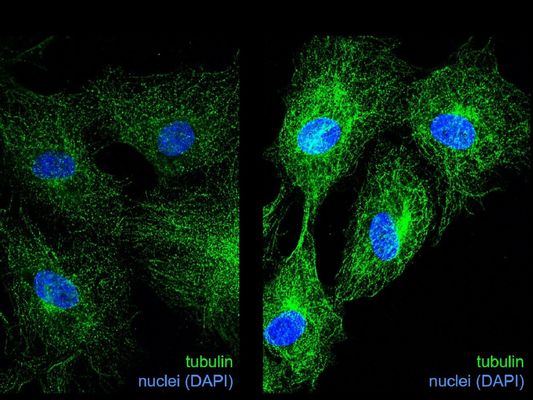 Tubulin immunofluorescence microscopy