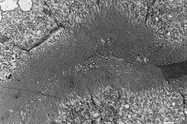 FLI: Microvilli of an N. furzeri proximal renal tubule