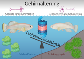 Gehrinalterung