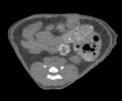 FLI: Density-based grayscale image FLI: Density-based grayscale image