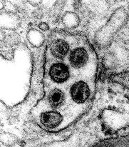 Electron microscopic picture of a vacuole infected by immunodeficiency viruses